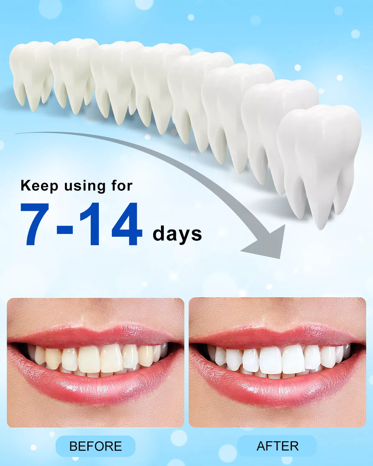 SmartGlow™ 5-LED Teeth Whitening Accelerator with 10-Minute Timer